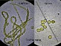 Trichia varia-amf1837-micro